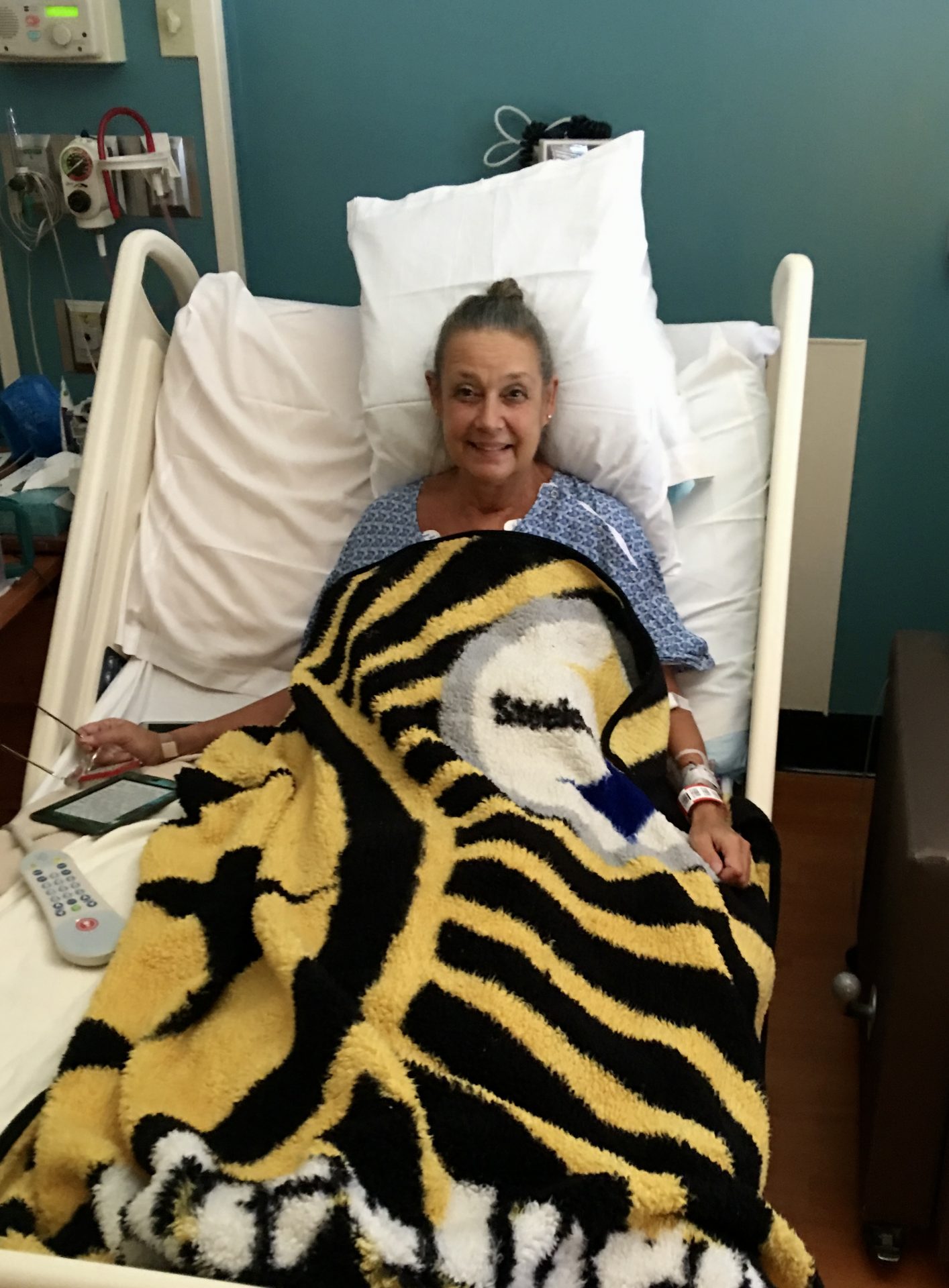 Recovering open heart